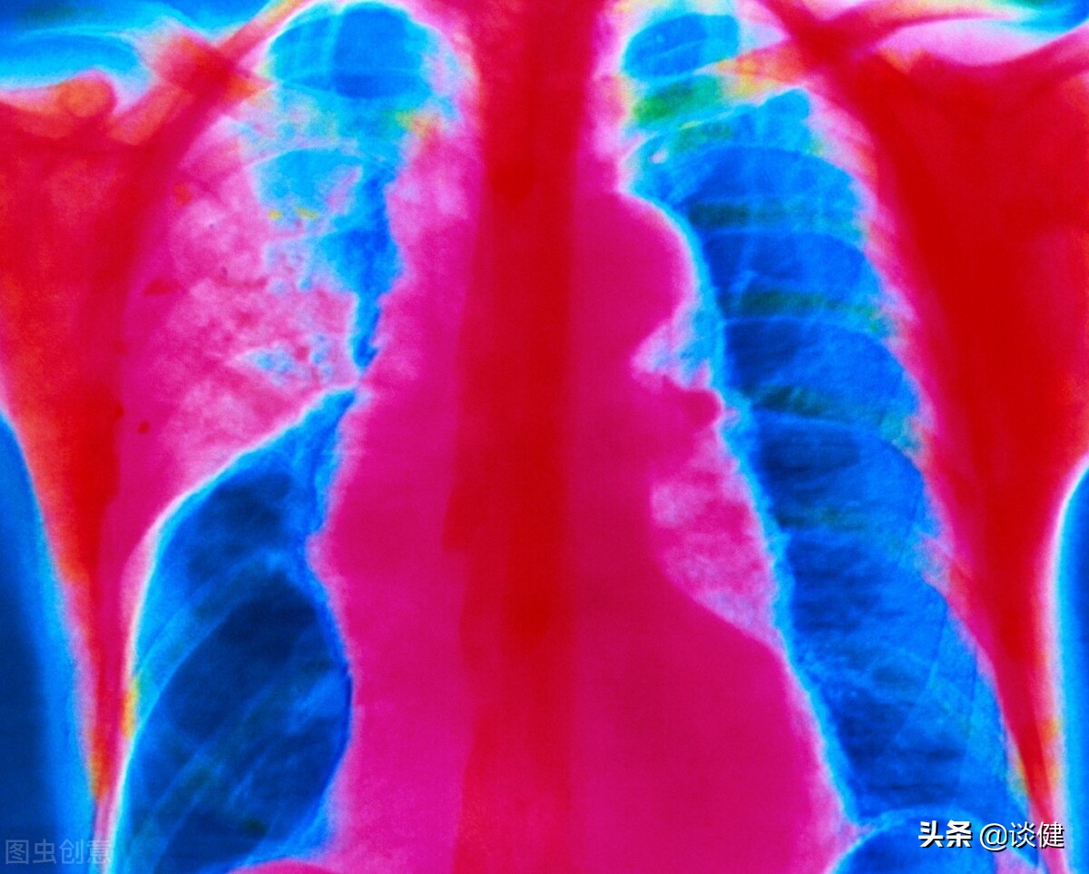 肺炎患者怎么预防受凉,肺炎38.4度高龄怎么物理降温