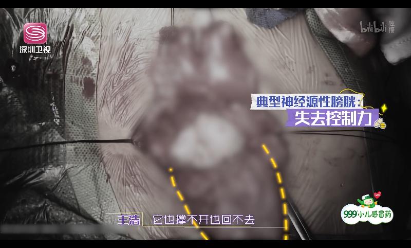 图片怎么满屏打码,给图片打码怎么打满屏