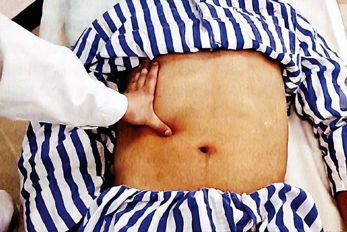 吃煎鸡蛋胃疼,无胆囊吃煎鸡蛋后胆区疼痛