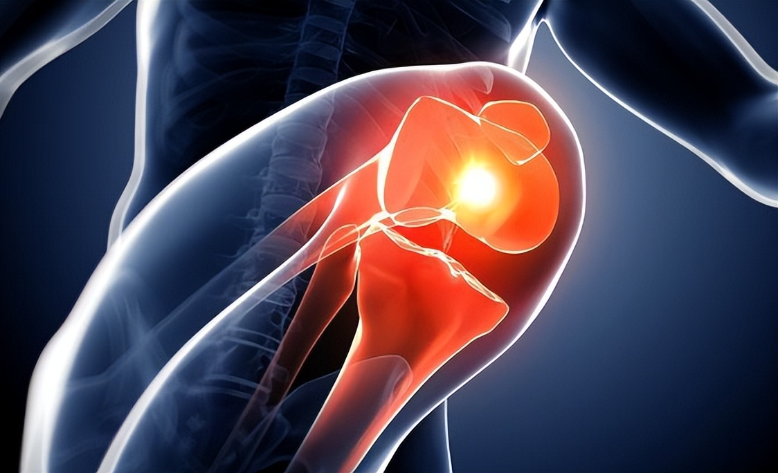 氨糖关节修复液,关节修复吃哪种氨糖