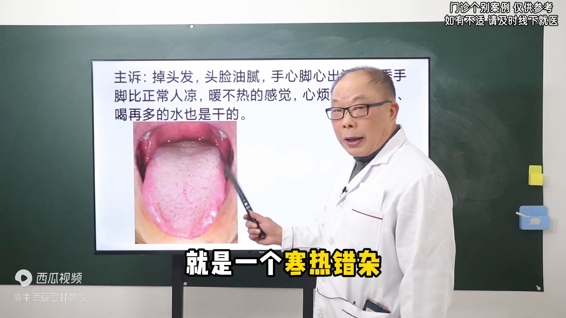 头脸出油手脚凉寒热错杂脾虚这样通阳气就好了