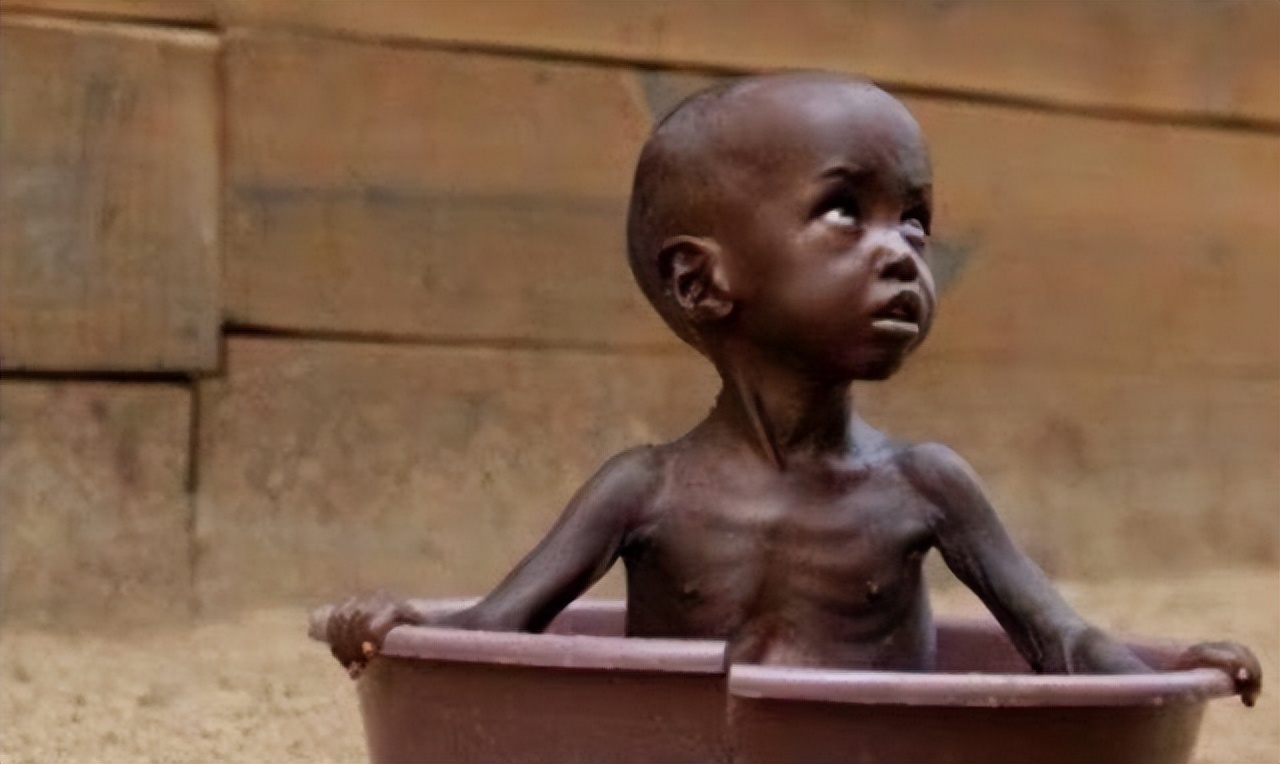 2016年,那个被白人美女喂水喝的2岁非洲小男孩,后来怎么样了?