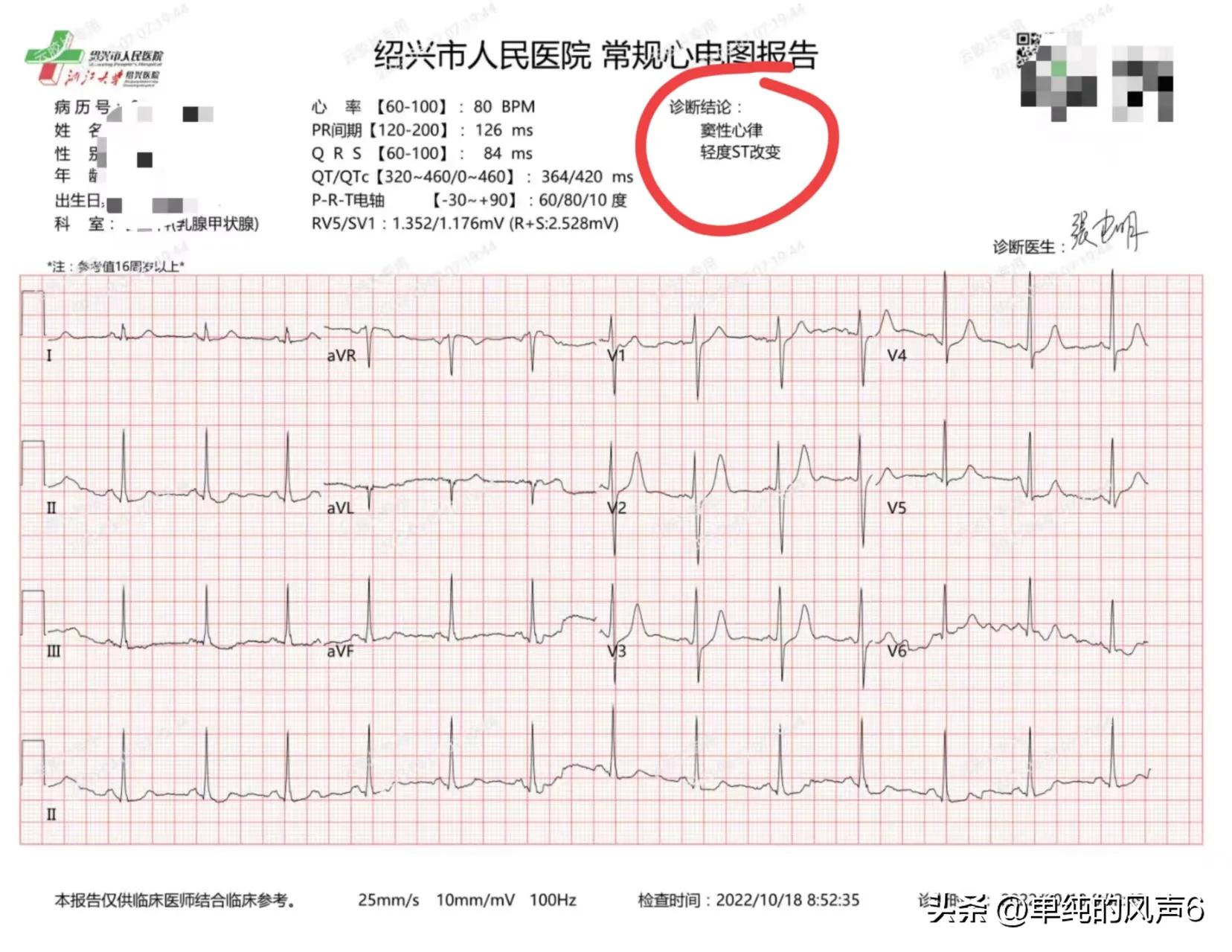 乳腺癌复查后肝内偏高回声区血管瘤各项指标都异常要不要复查？