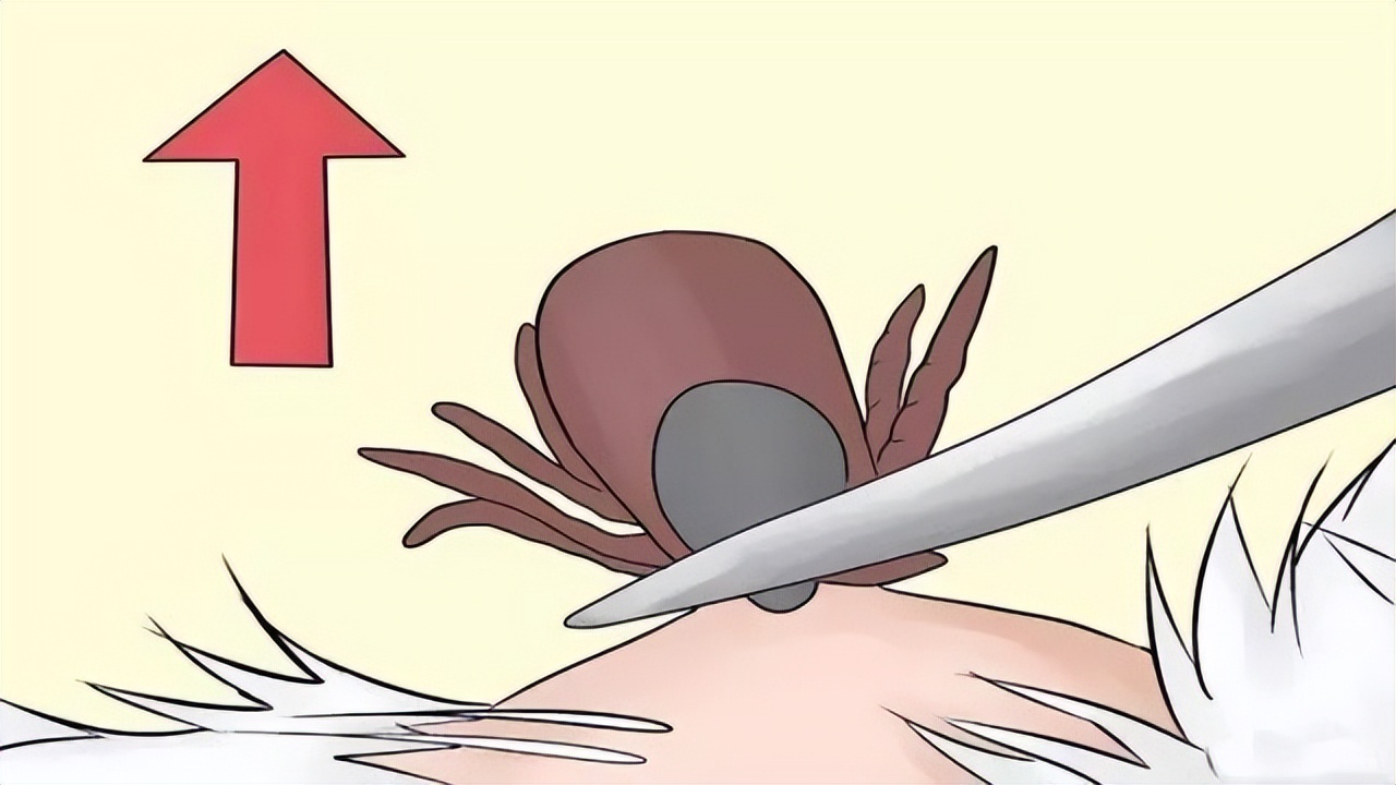 阴虱是什么？为啥有人好端端就染上了？医生：离不开5个传播途径