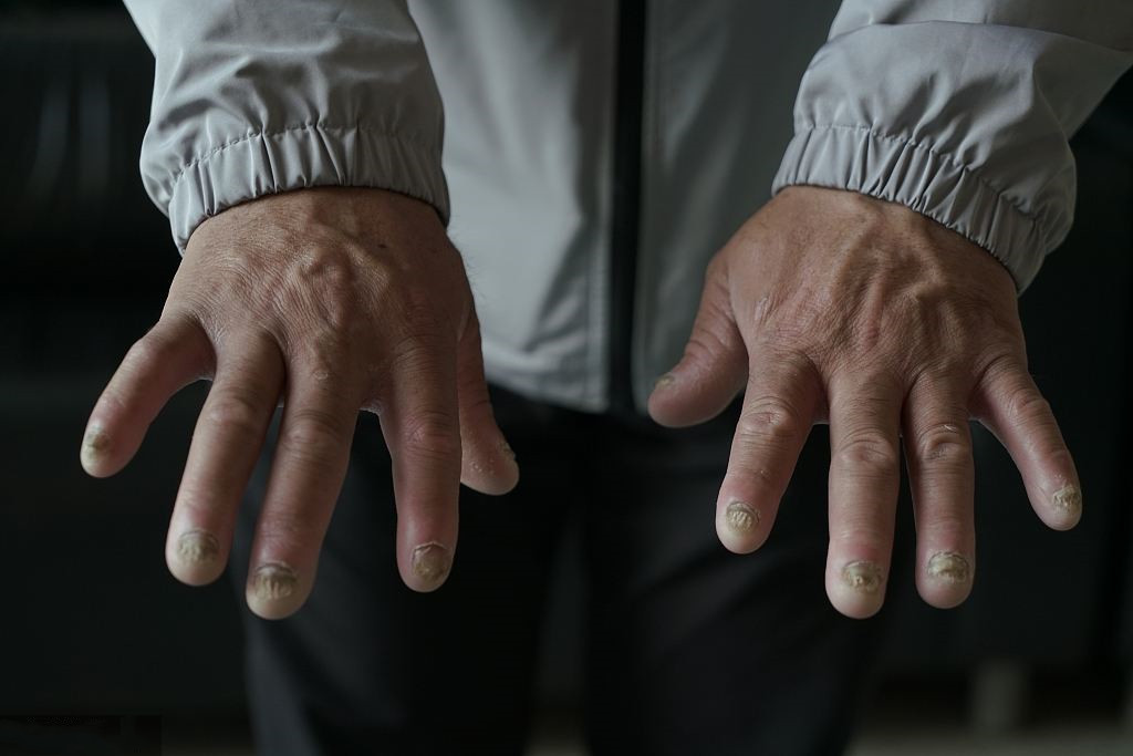 表姐夫被法院判了七年,表姐夫花59万