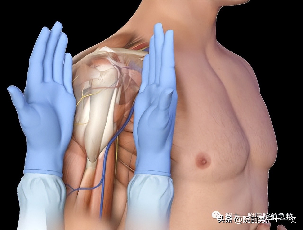 骨髓腔穿刺急救,骨髓腔穿刺适应症和禁忌症