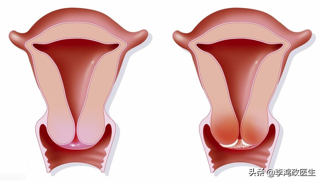 什么体检项目是筛查癌症最好方法,女性癌症筛查体检项目几年一次