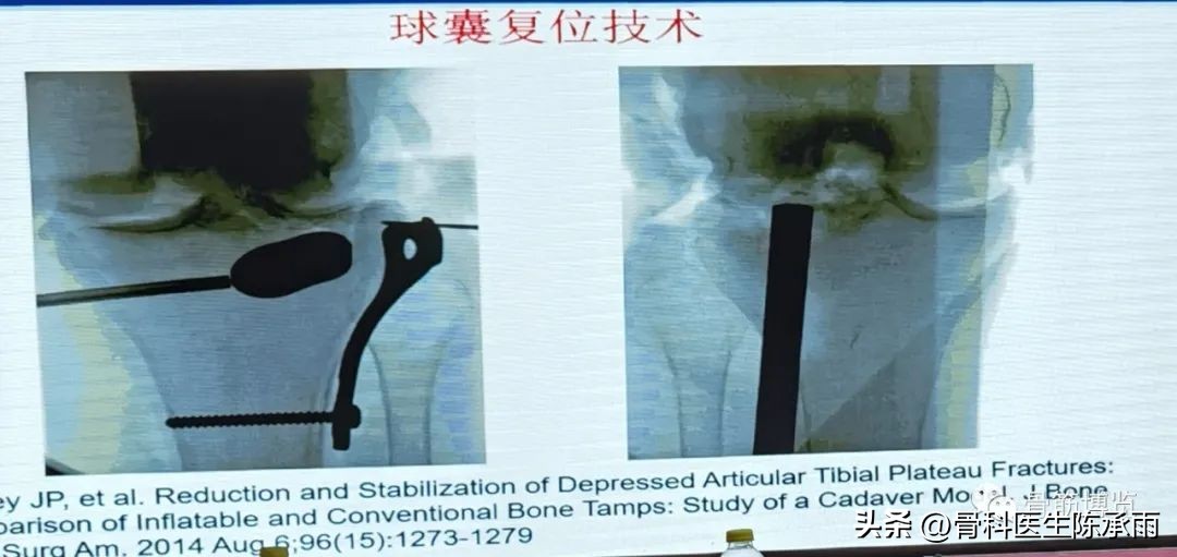 国家卫健委主办的骨创伤专项能力培训项目----下肢损伤学习班