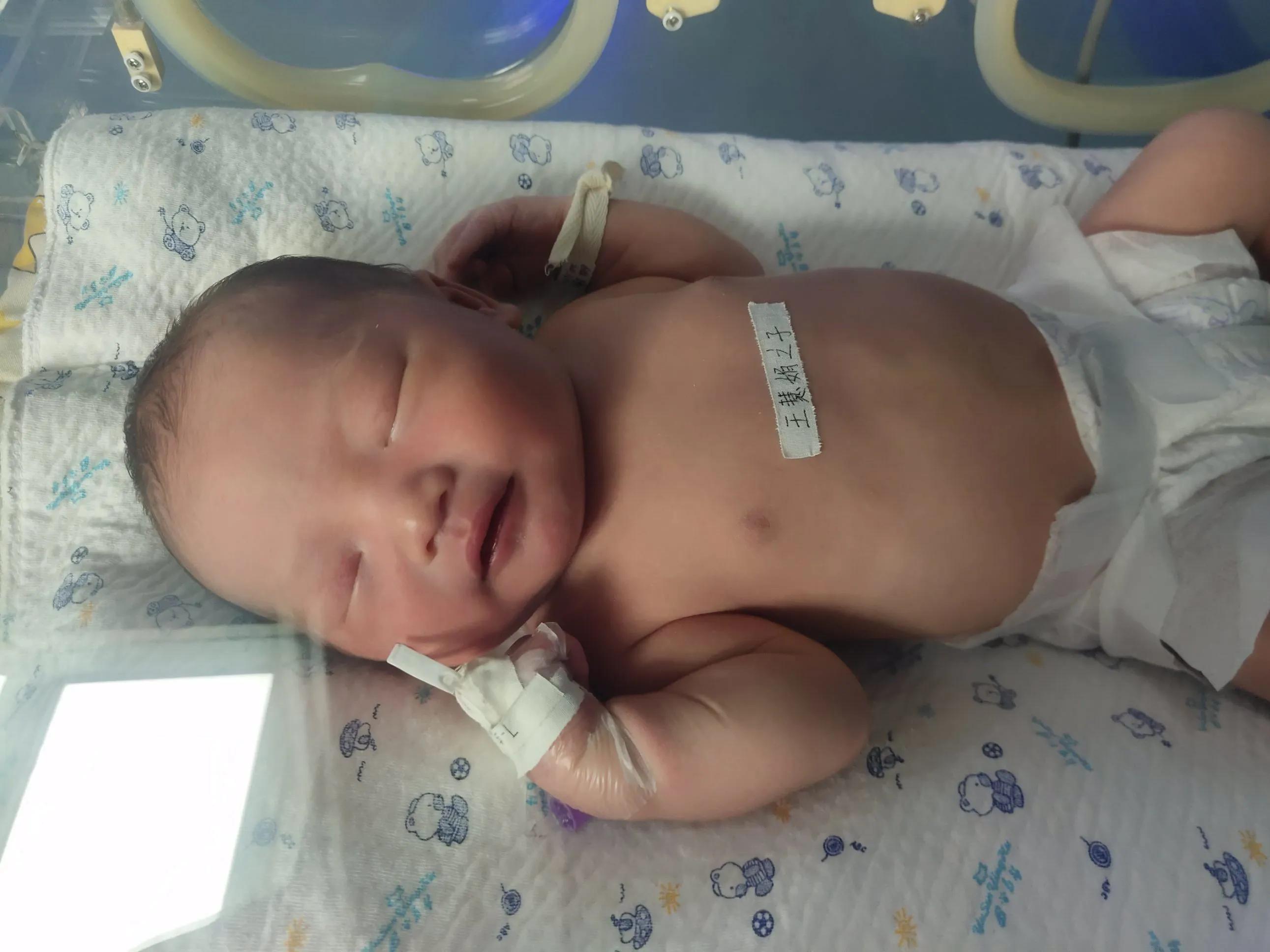 宝宝出生经历磨难,宝宝出生经历了哪些过程