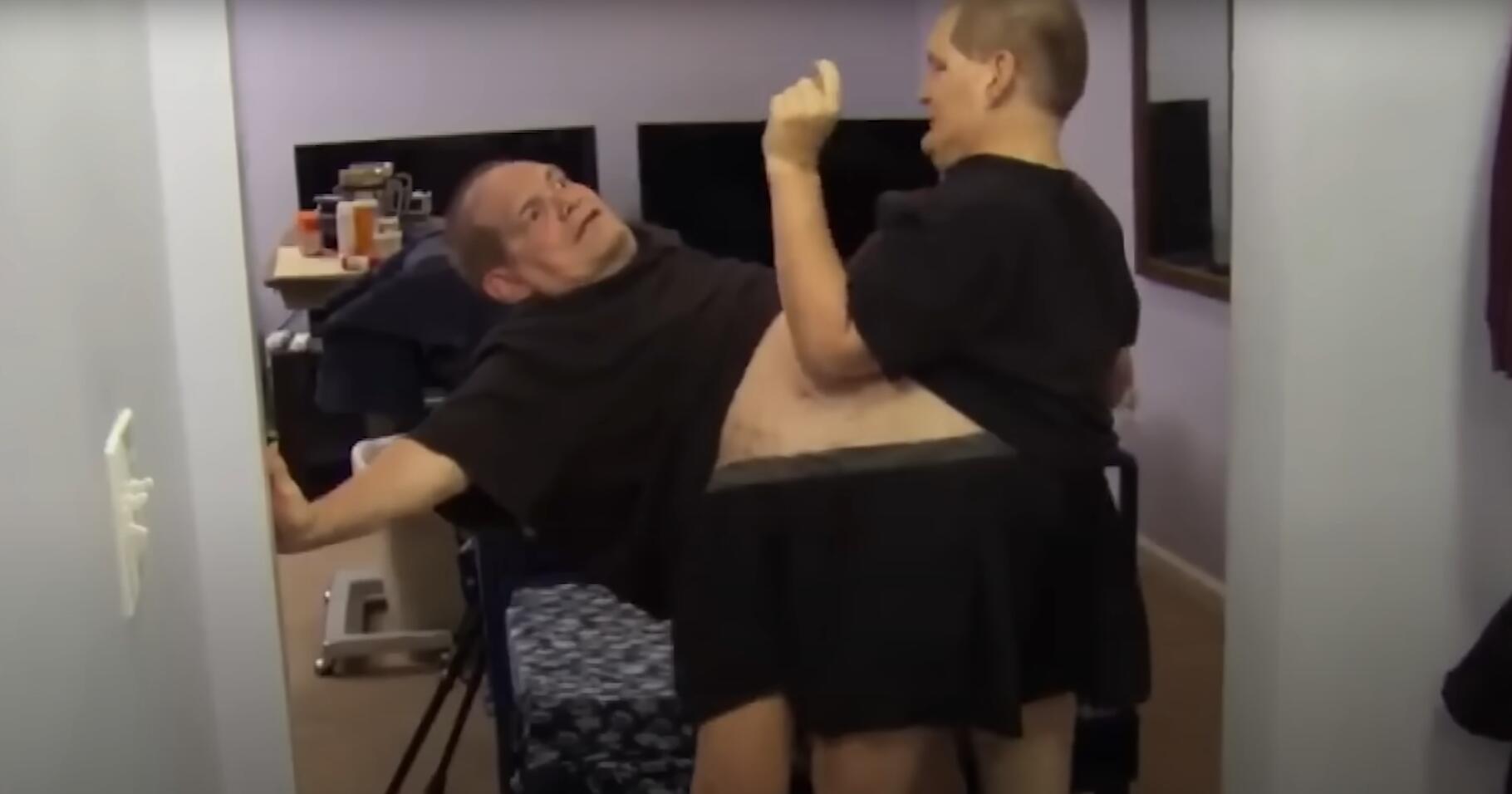 10个难以置信的人类，树皮人、外星人、拥有粗壮手臂的大力水手