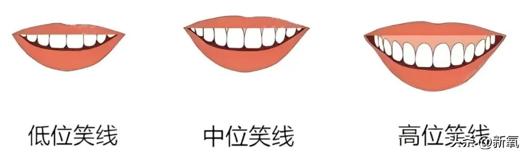 牙齿正畸和骨骼正畸的区别,牙齿正畸和眼轴增长有关系吗