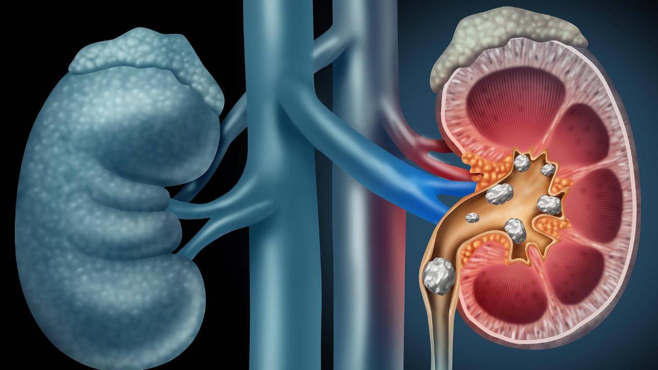 糖尿病人科学喝水,糖尿病人饭前喝水还是饭后喝水