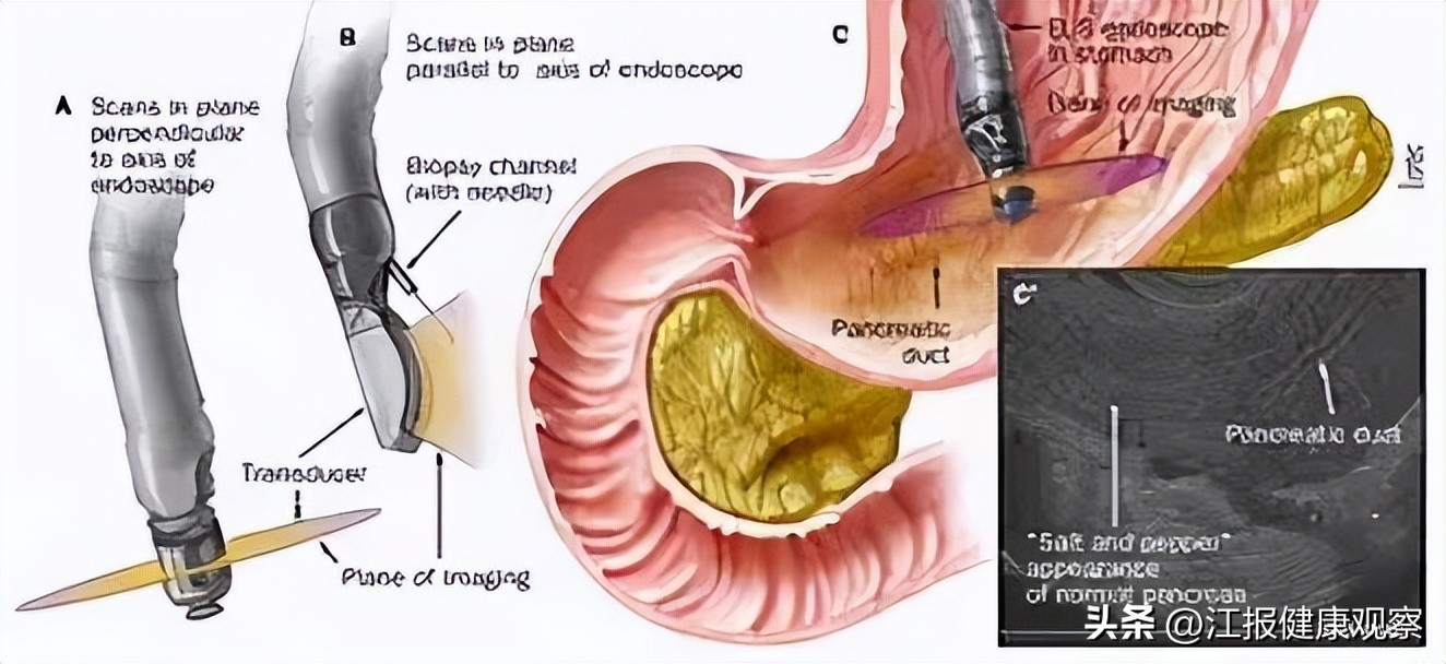 比ct更高级的检查仪器,比ct更清晰的检查是什么