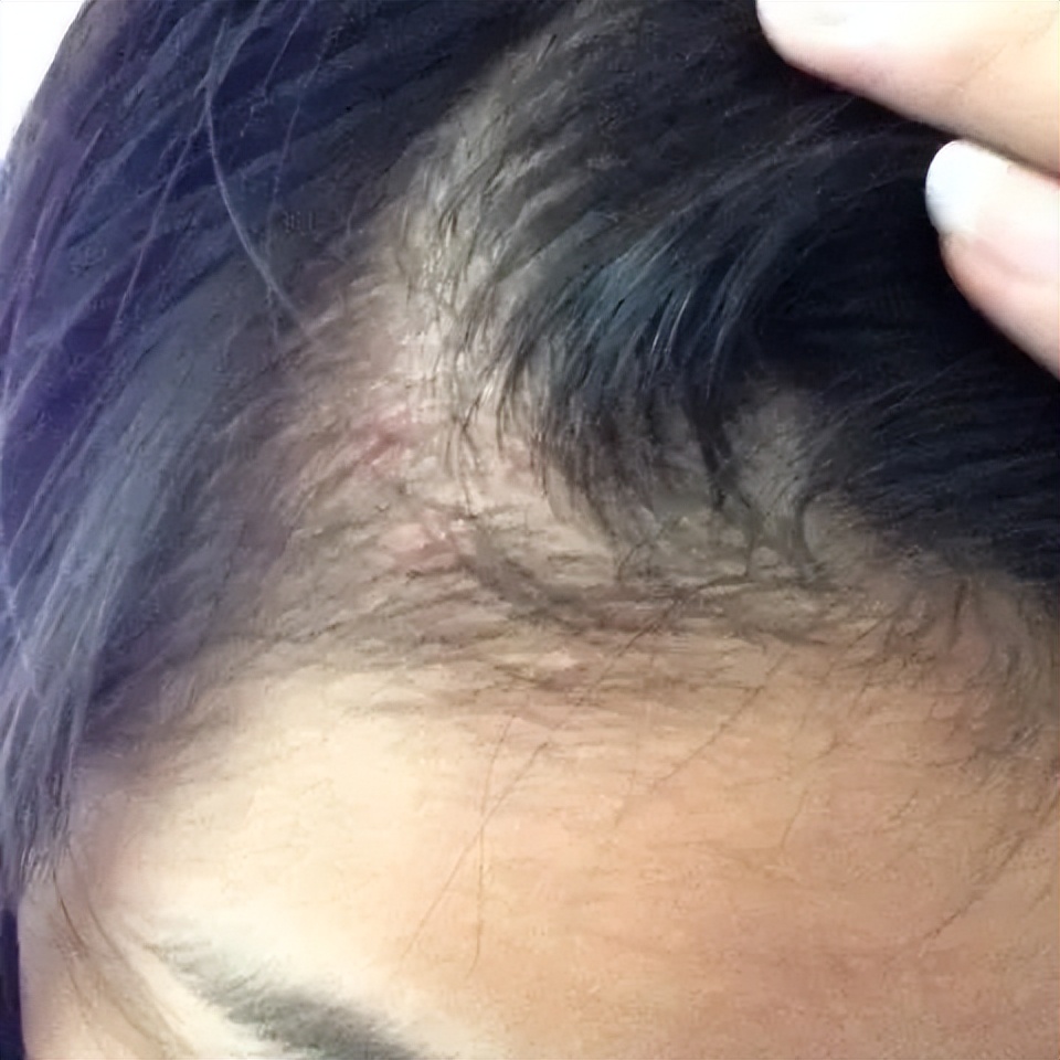 最简单自己弄头发,教大家如何在家打理头发