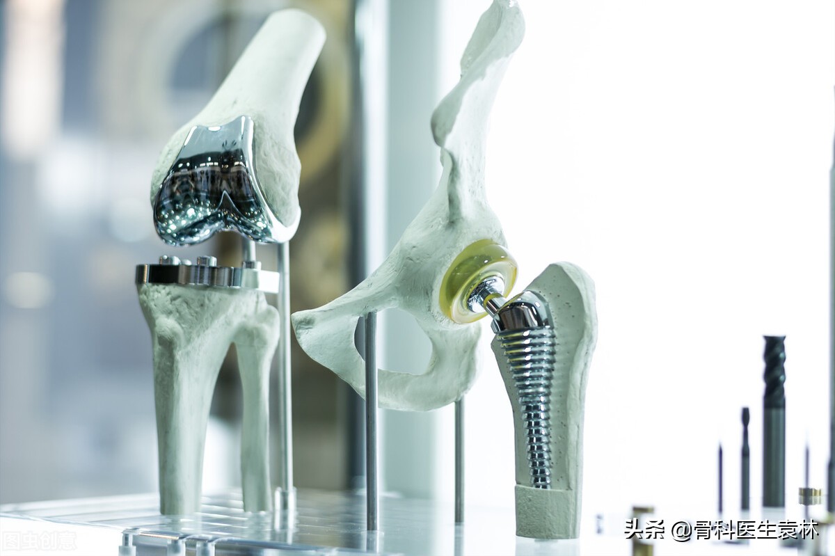 膝关节置换60天走路是什么效果,膝关节置换术后康复训练