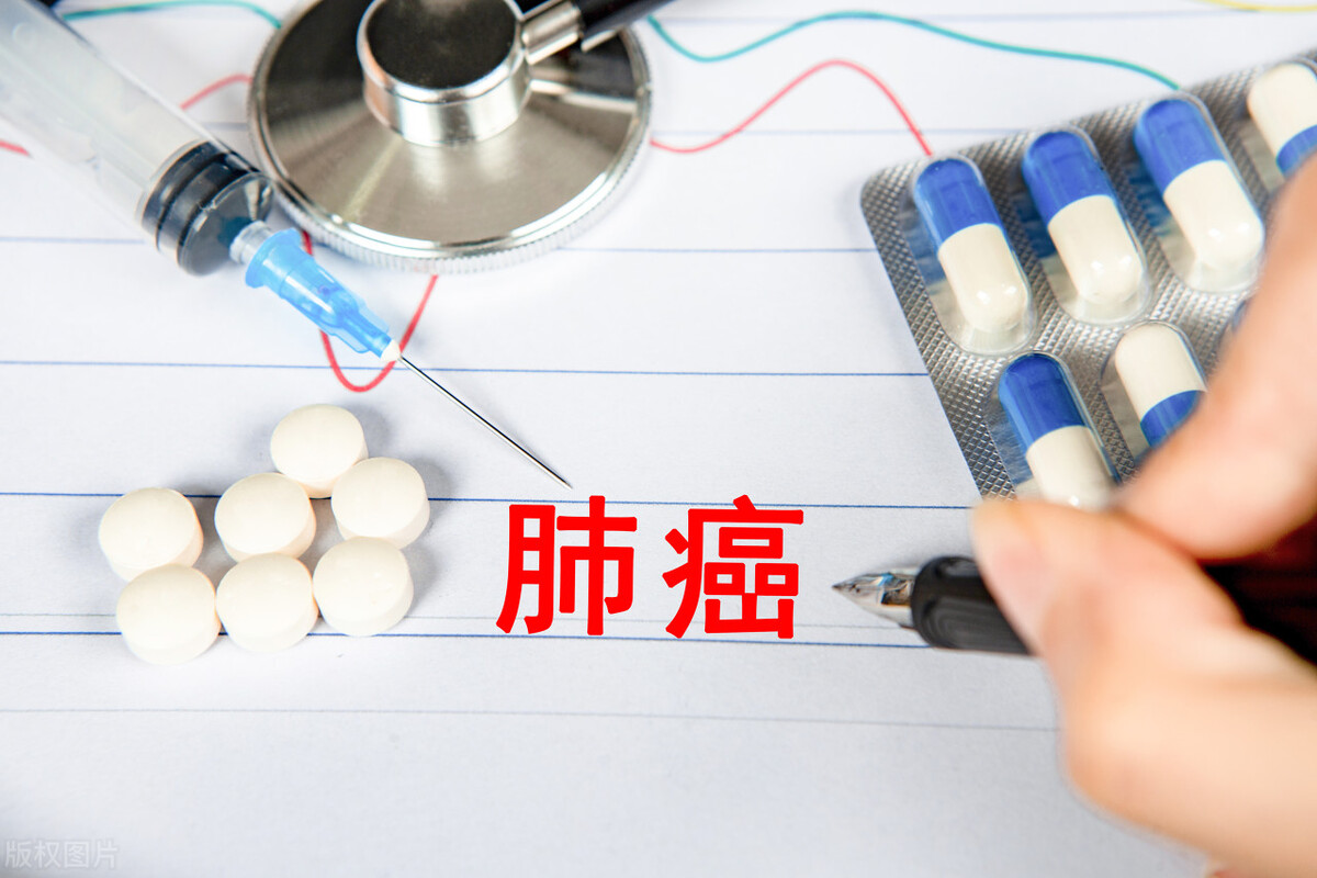 肺癌的早期症状及表现肩膀痛,肺部长肿瘤是不是癌