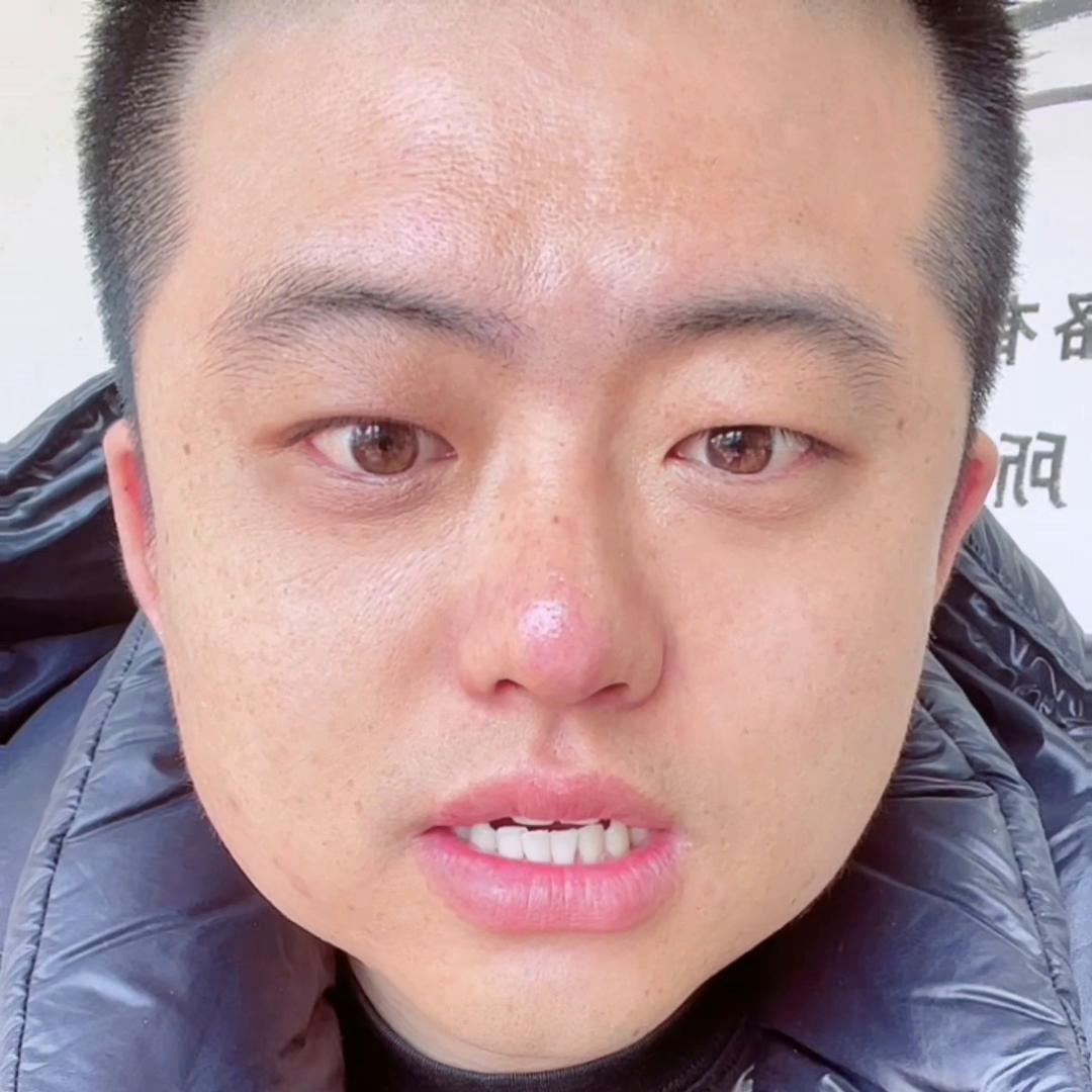 买二手车要小心,二手车合同不盖公章只按手印