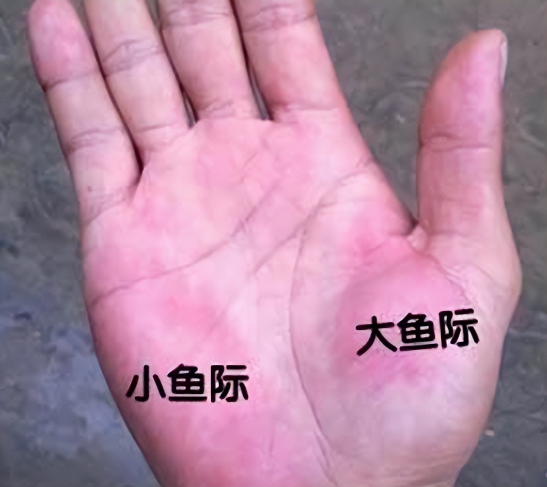 如何识别肝掌,如何辨别肝掌