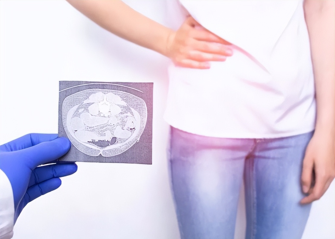 阑尾炎症状表现有哪些要做手术吗,阑尾炎的位置症状表现和治疗方法