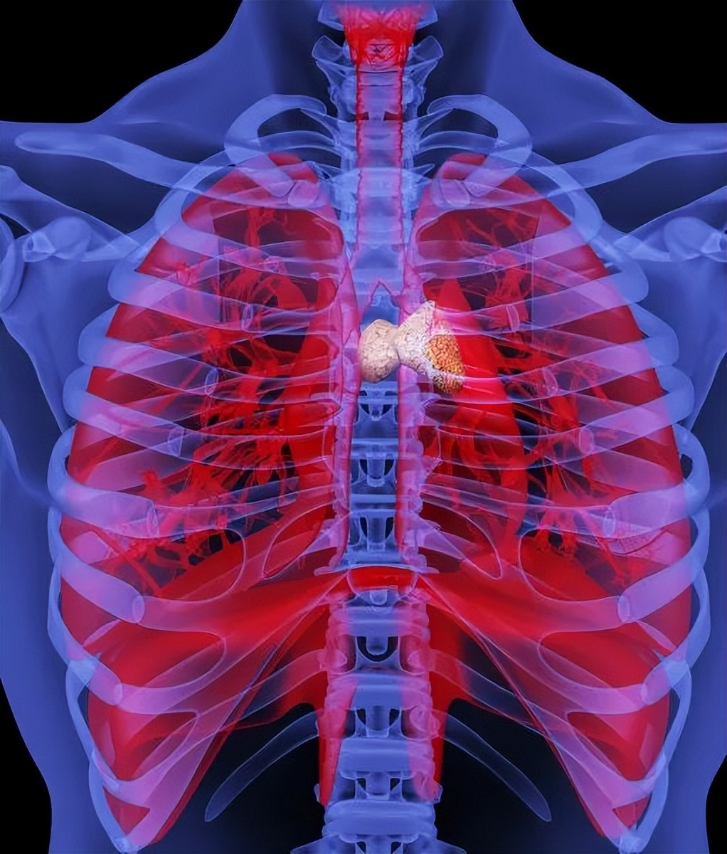 眼皮抬不起来了真困,眼皮抬不起来是阳吗