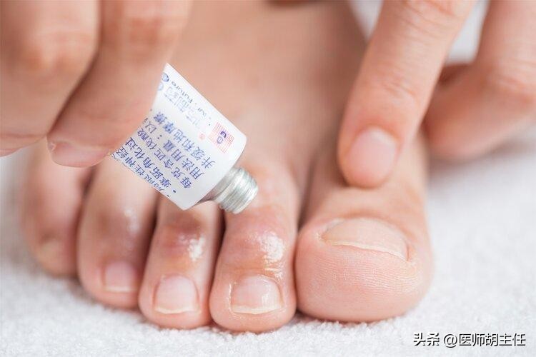 湿疹和荨麻疹汗疱疹同时出现吗,汗疱疹后期干裂瘙痒用什么药