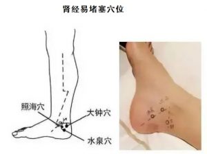 十二经络足阳明胃经穴位走向,胃部经络最易堵塞三个穴位