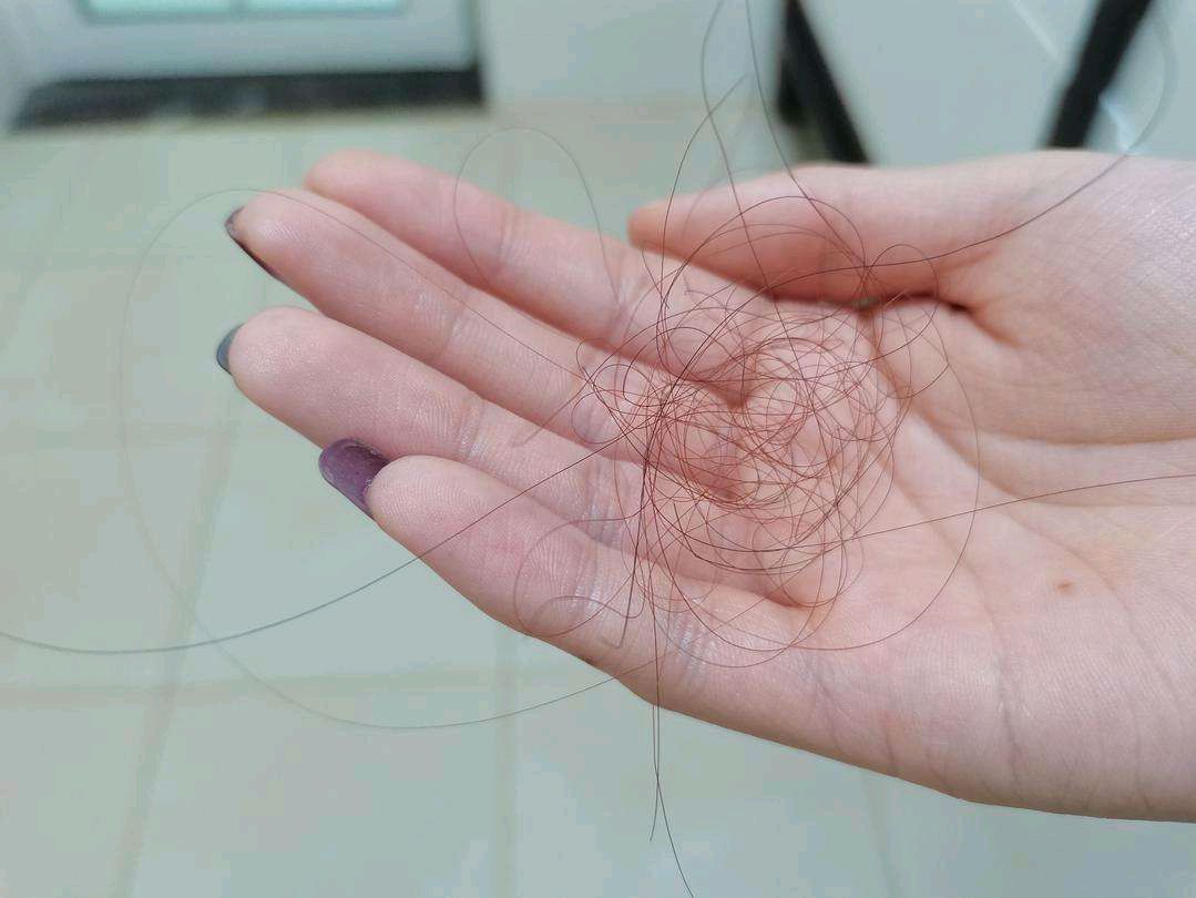 生姜洗头发有什么功效,长时间用生姜洗头发会怎么样