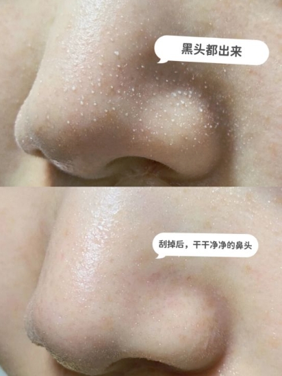 60岁妈妈护肤品推荐排行榜第一名,十大37岁女的国货良心护肤品