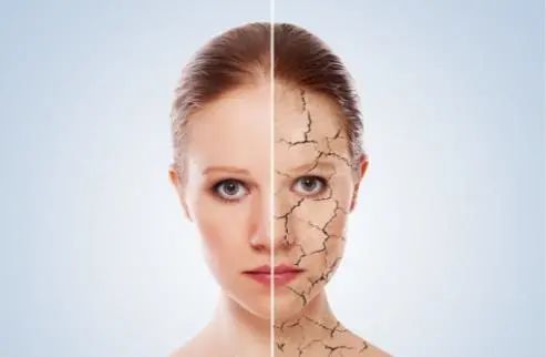 干燥肌急救小妙招,皮肤干燥保湿三部曲