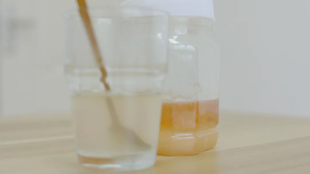 乳腺纤维瘤切除手术后还会复发吗,乳腺纤维瘤手术切除后注意事项