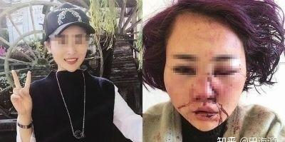 唐山被打女子伤情鉴定出来了吗,唐山被打女生伤情鉴定解说