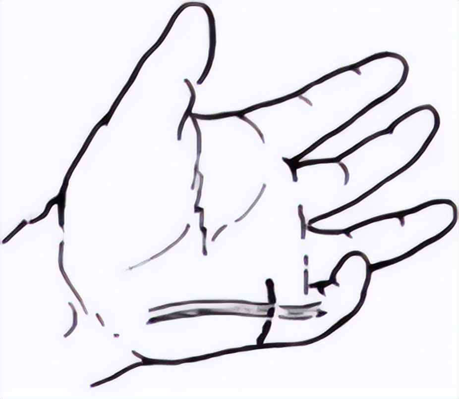 关注罕见病的视频,歌舞伎综合征是什么意思