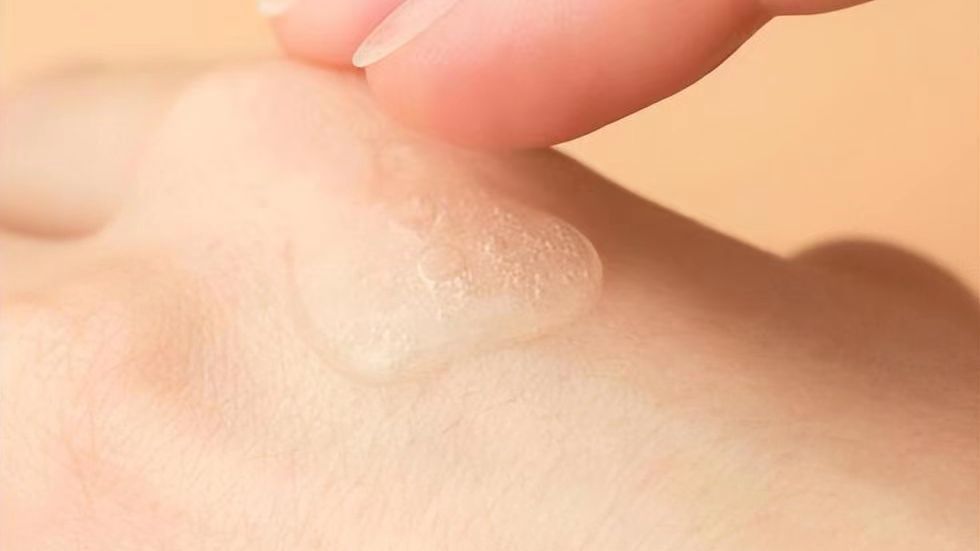 女性*处私**的润滑液是如何产生的？如何改善*处私**干燥？医生告诉你