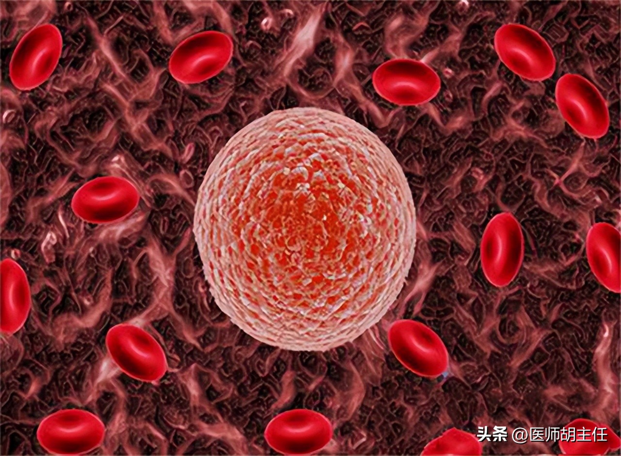 体检发现胆红素高是怎么回事,体检胆红素高怎么快速降下来