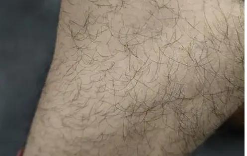 女性思想病态化,女性如何处理生理性毛发