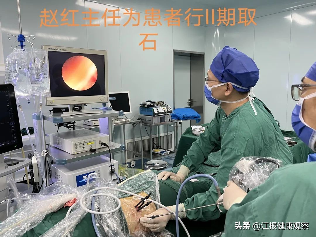男子结石困扰20余年，南昌市中心医院（江西省中西医结合医院）泌尿外科团队精准清除左肾完全性铸型结石