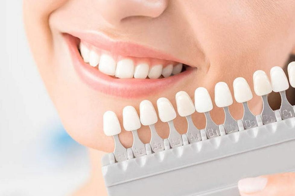 烤瓷牙的缺点危害亲身经历,烤瓷牙各有哪些优缺点