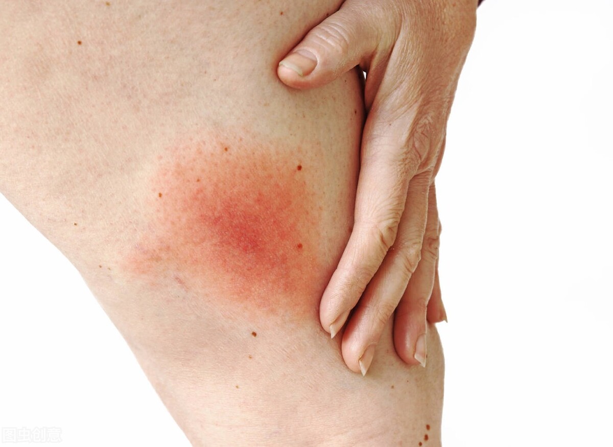 乱用阿莫西林的后果是什么,认清阿莫西林只对这5种病有效