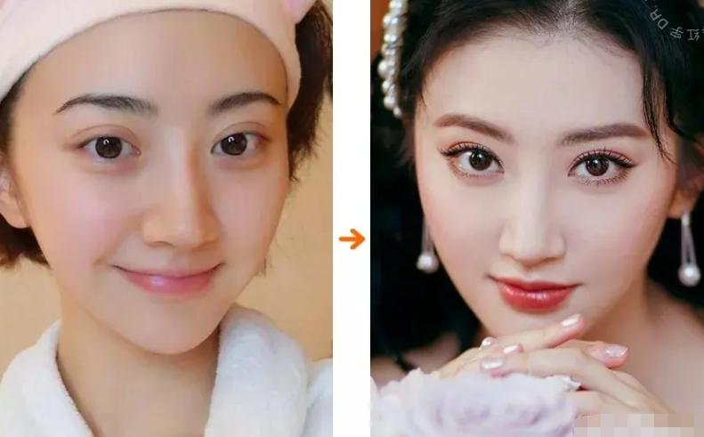 割了双眼皮颜值大增的明星,论娱乐圈割双眼皮最失败的明星