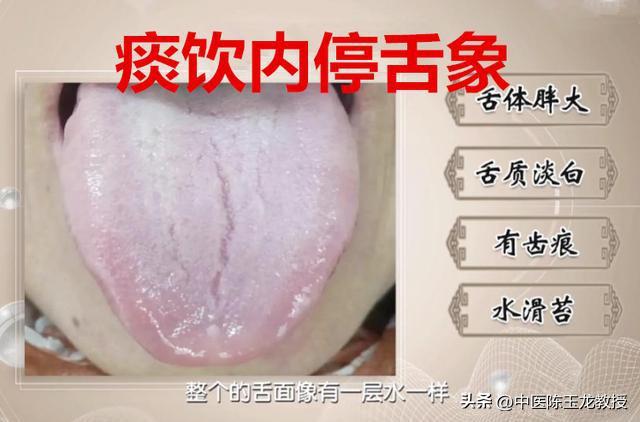 饭后总是胃胀烧心,饭后总是胃酸胃胀怎么回事