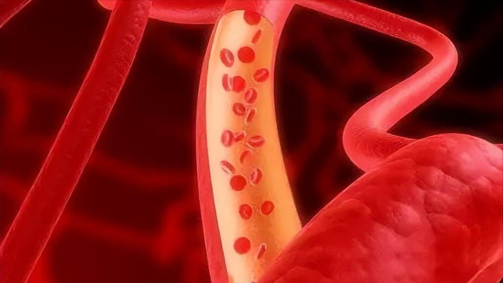 注意！性功能障碍不仅困扰男性，多数女性有苦说不出，该如何应对