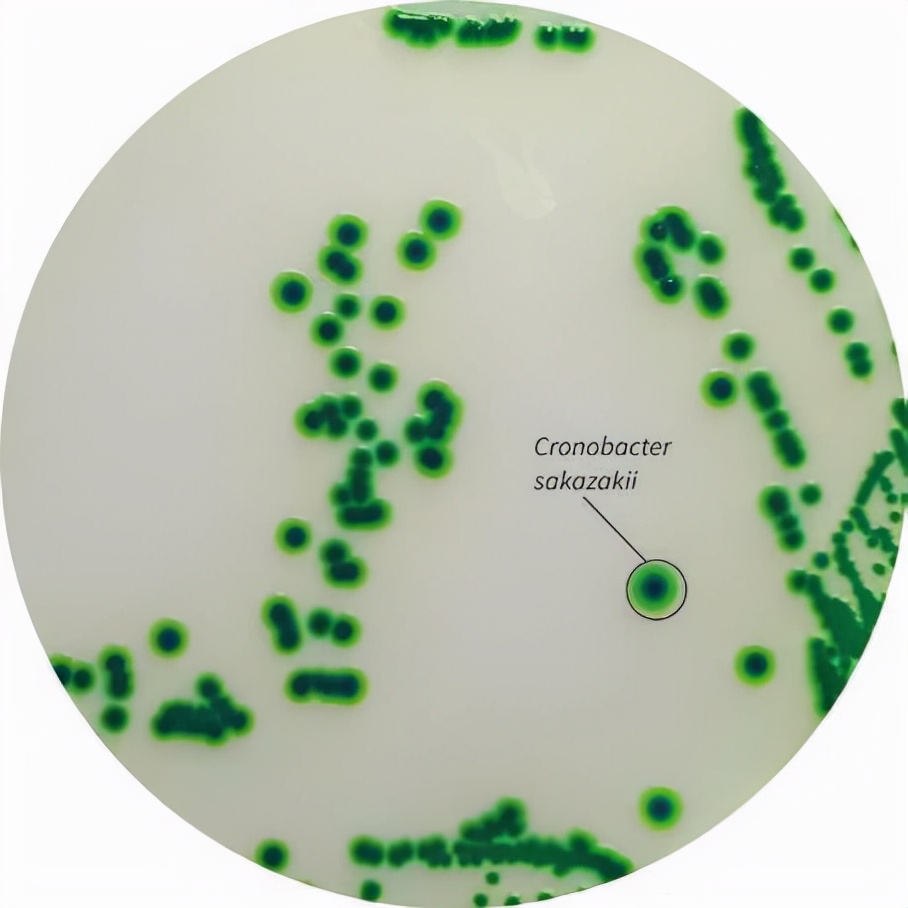 食源性过敏原,食源性致病菌引发的国际案例