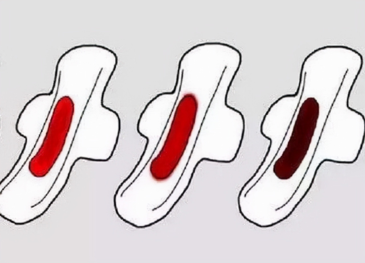 为啥在月经结束后，会有“褐色分泌物”？妇科医生告诉你答案