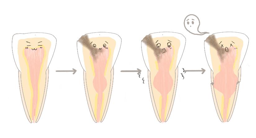 牙齿被牙龈吸收了怎么办,牙齿被吸收一半会有什么反应