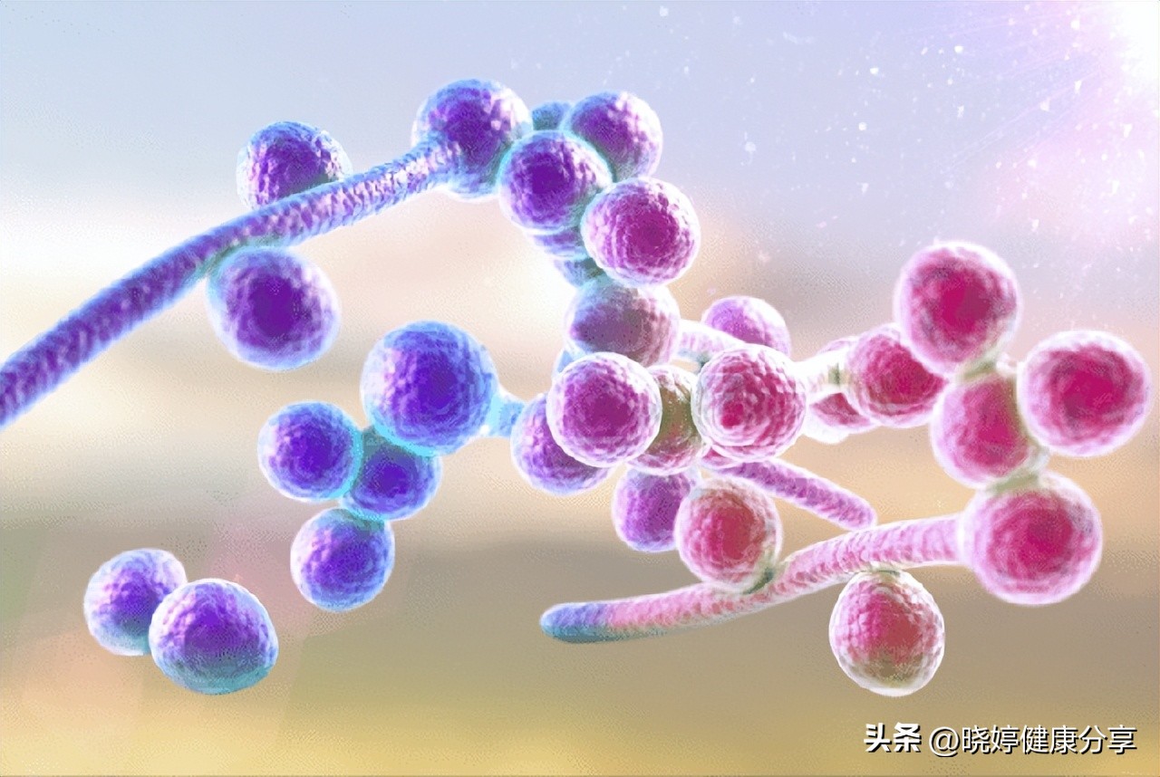 阴道酵母菌感染会导致什么症状,阴道酵母菌感染的症状