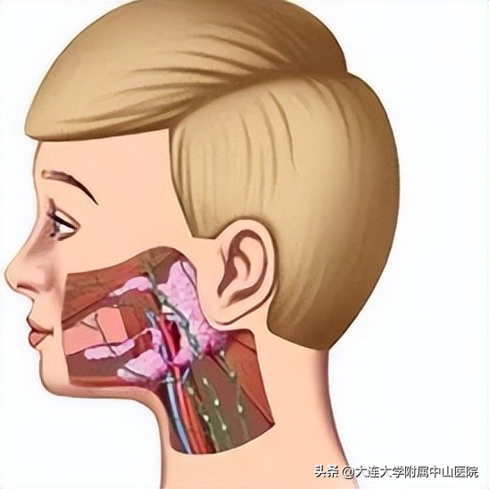 流行性腮腺炎少儿频道,流行性腮腺炎腮腺肿大的特点是