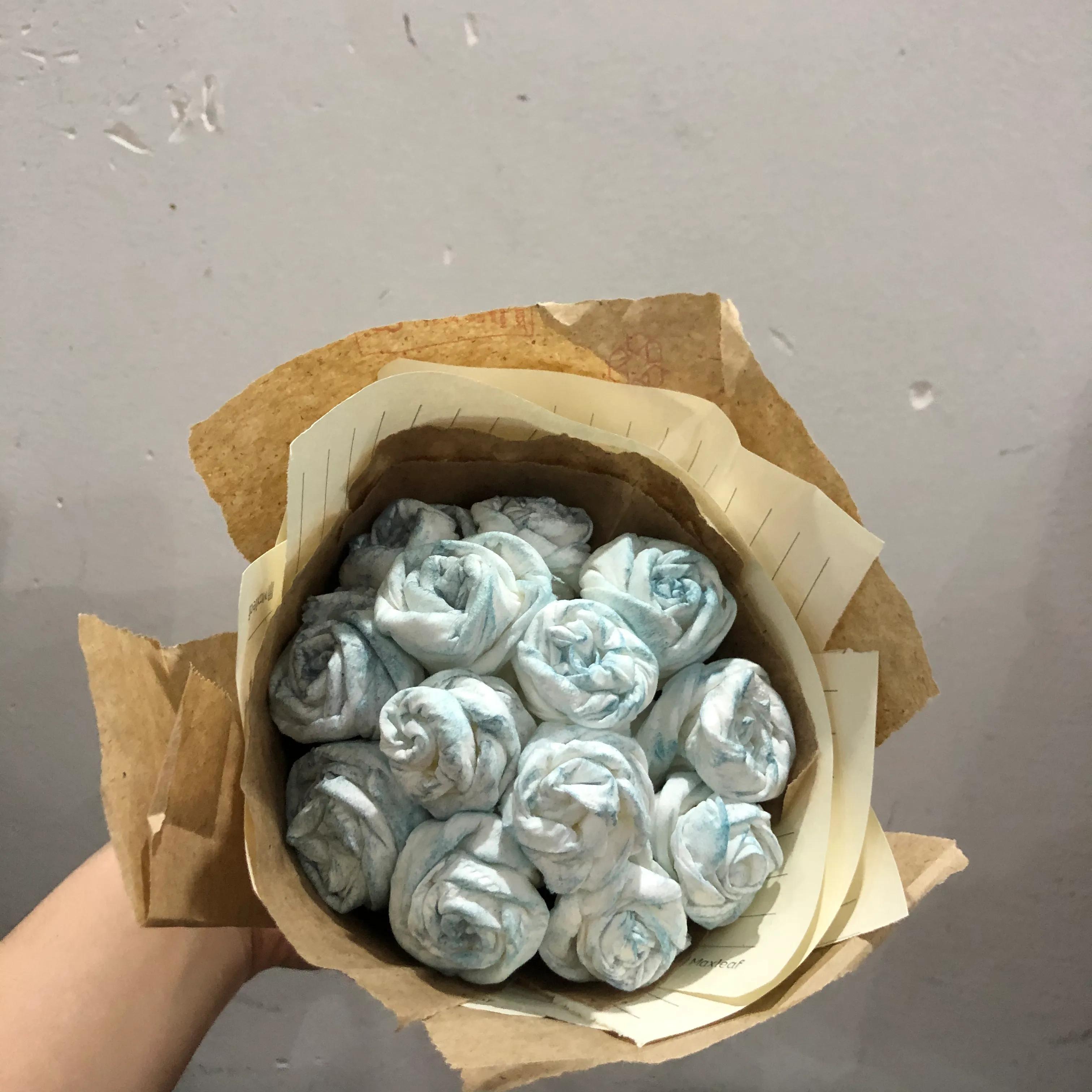 剖腹产几天可以洗澡注意什么,剖腹产后第二天需要注意什么