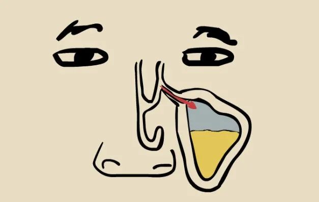 鼻窦发炎眼睛会持续疼还是偶尔疼,为什么得了鼻窦炎头很疼