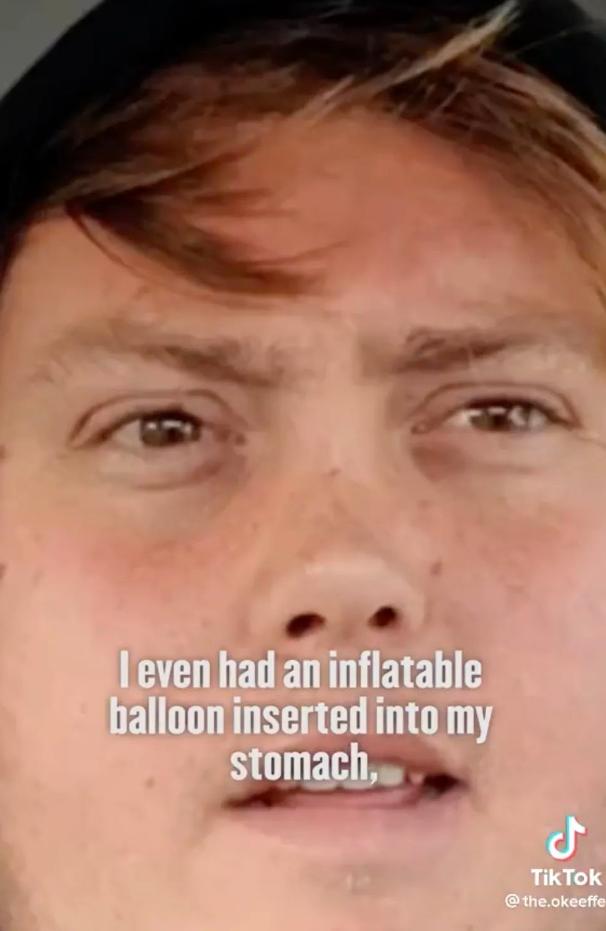 300斤小伙成功减掉半个自己,150斤男人断食减肥一个月