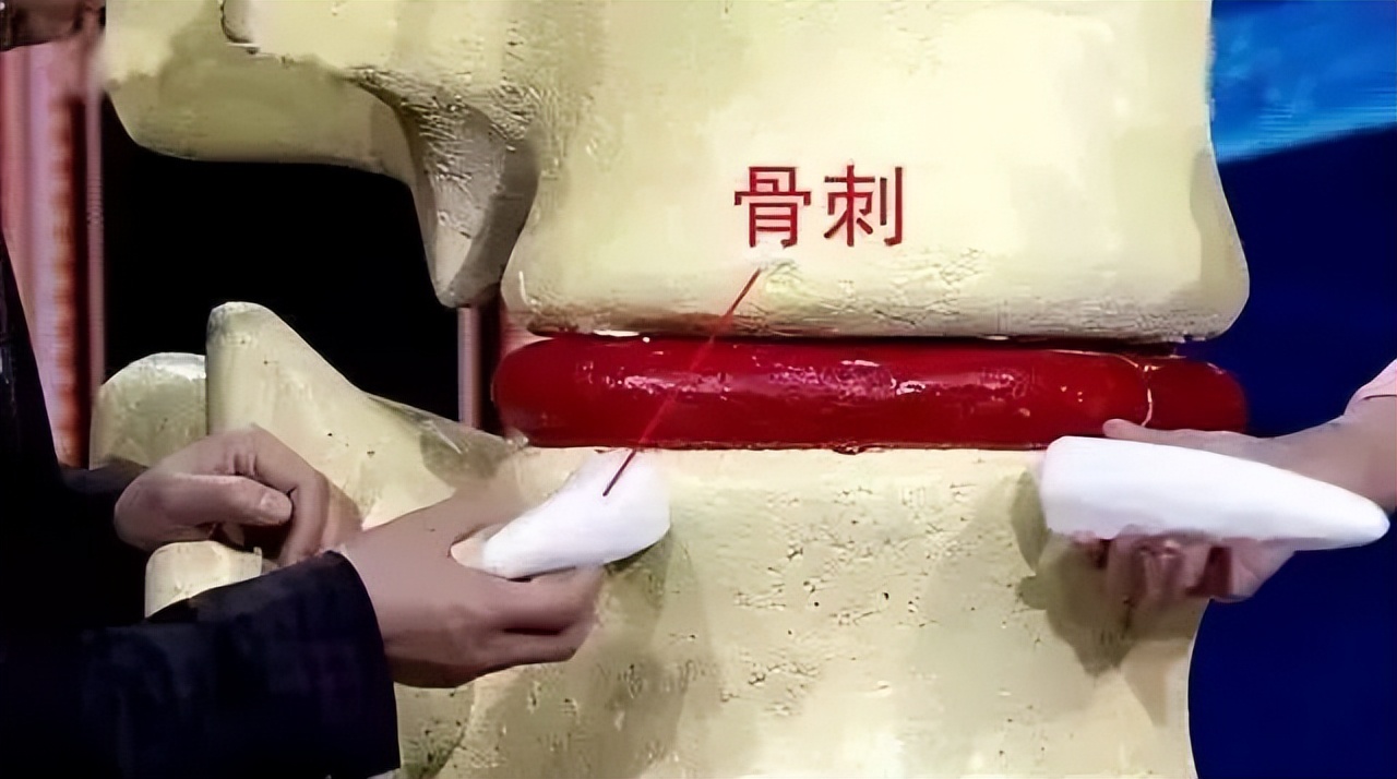 膝关节老化多大开始,膝关节问题发现越早越好